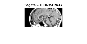 图中包含一个轴对象。标题为矢状- TFORMARRAY的轴对象包含一个类型为image的对象。