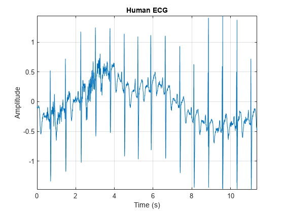 图中包含一个Axis对象。标题为Human ECG的Axis对象包含一个line类型的对象。