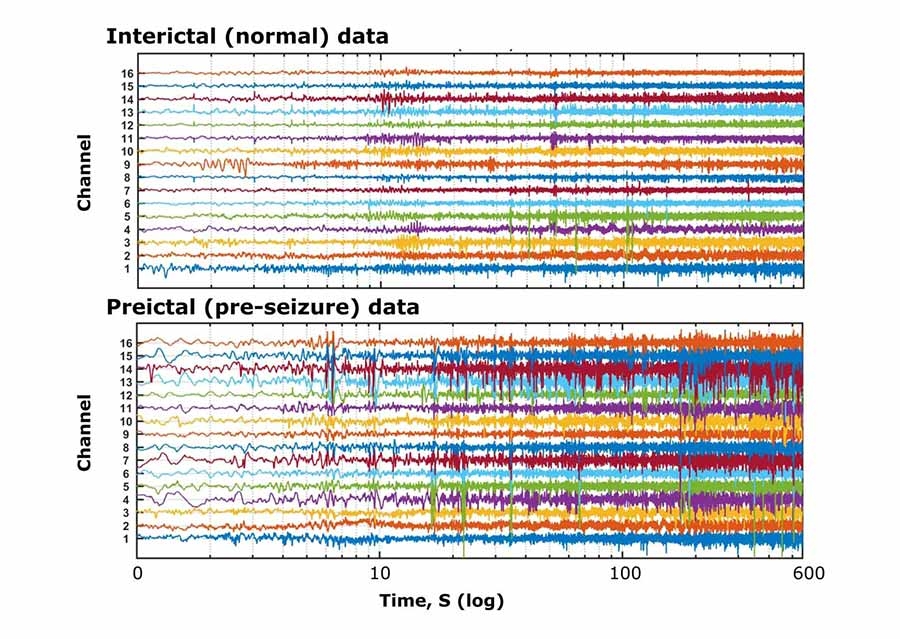 由Kaggle提供图1颅内EEG数据。