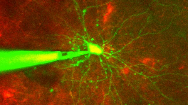 细胞神经科学实验图像处理的自动控制