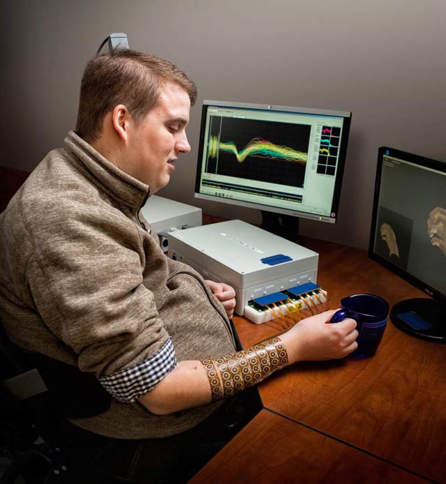 Battelle神经旁路技术将运动恢复到瘫痪的男人的手臂和手