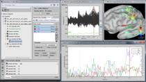 MathWorks和头脑风暴工程师将演示头脑风暴提供的基本工具，以分析和可视化从电生理记录获得的多维、复杂数据集，重点是功能性脑成像。我们