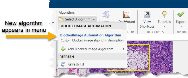 Add new algorithm to Select Algorithm menu.