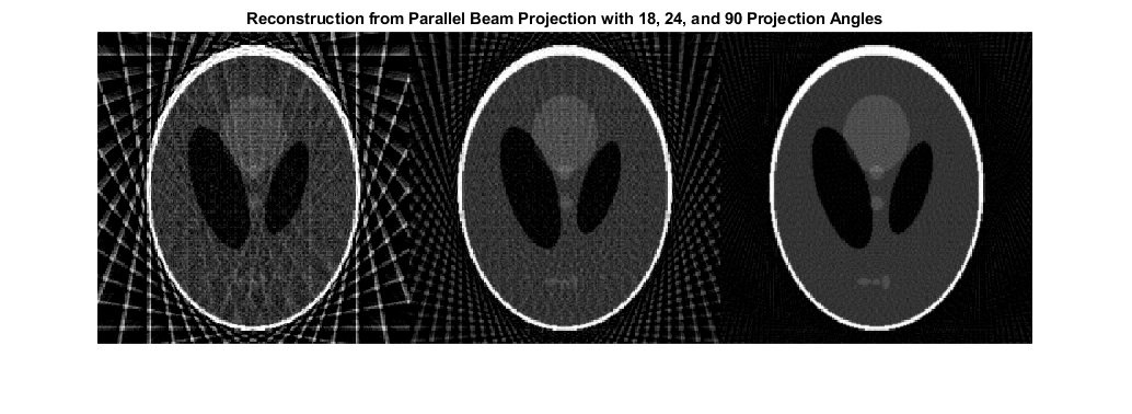 图中包含一个轴对象。标题为“从平行光束投影重建18、24、90投影角度”的轴对象包含一个图像类型的对象。