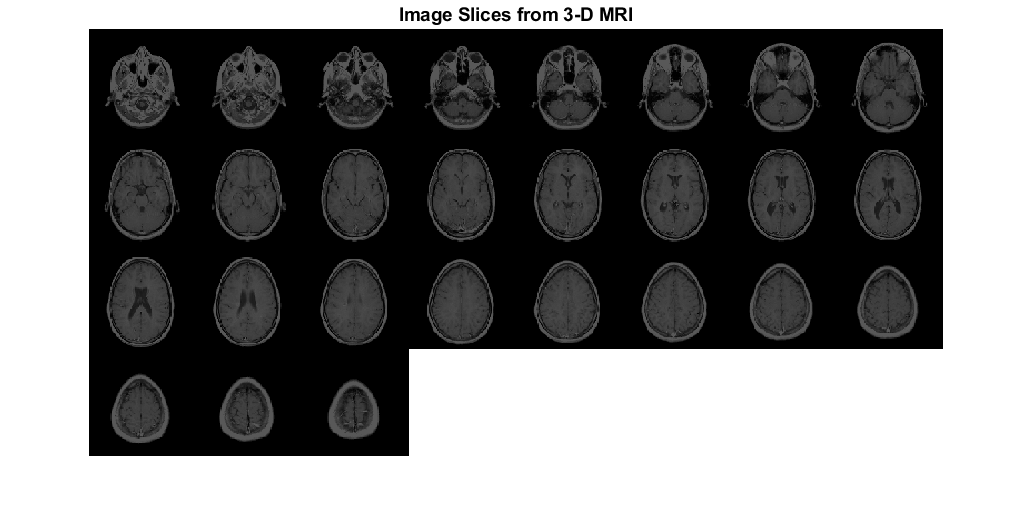 图包含一个轴。来自3-D MRI的标题图像切片的轴包含类型图像的对象。
