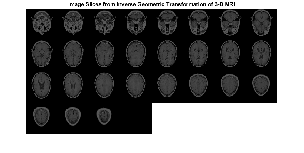 图包含一个轴。The axes with title Image Slices from Inverse Geometric Transformation of 3-D MRI contains an object of type image.