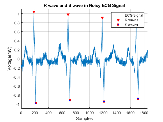图包含一个轴对象。The axes object with title R wave and S wave in Noisy ECG Signal contains 3 objects of type line. These objects represent ECG Signal, R waves, S waves.