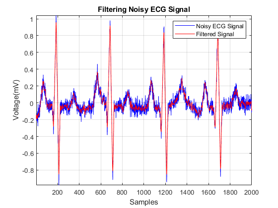 图中包含一个坐标轴。以滤波噪声心电信号为标题的轴包含2个线型对象。这些对象分别表示噪声心电信号和滤波信号。