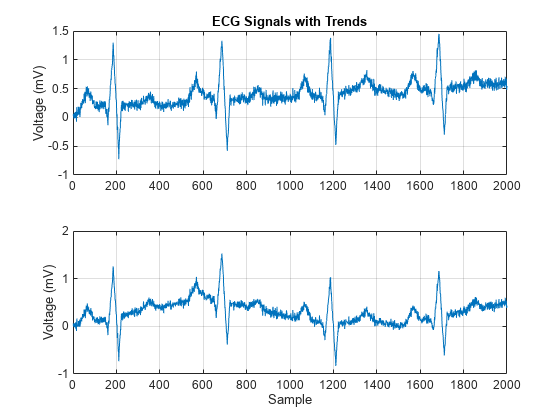 图包含2个轴对象。带有标题ECG信号的轴对象1带有趋势的对象包含类型线的对象。轴对象2包含类型行的对象。