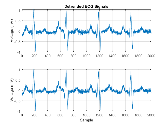 图包含2个轴对象。轴对象1带有标题的ECG信号包含类型线的对象。轴对象2包含类型行的对象。