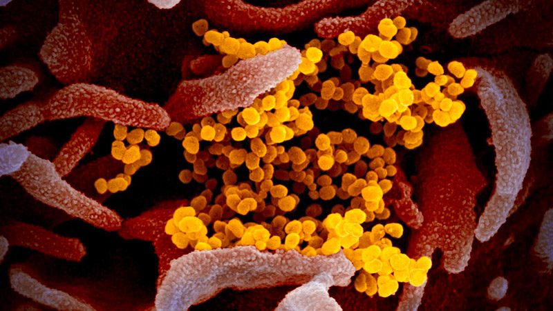 扫描电子显微镜图像显示SARS-CoV-2病毒(黄色)从实验室培养的细胞(粉色)表面出现。图片来源:NIAID-RML