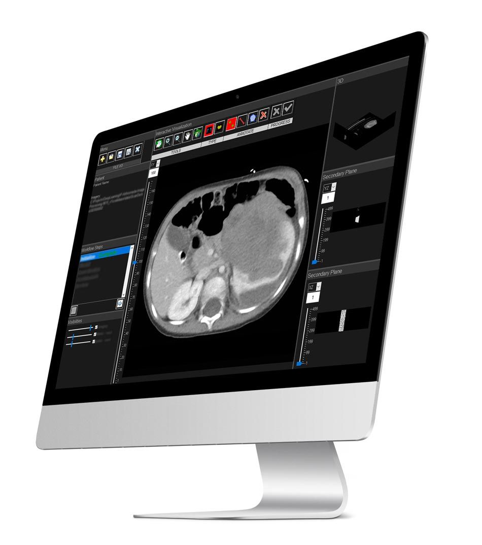 用MATLAB在计算机屏幕上处理医学图像。
