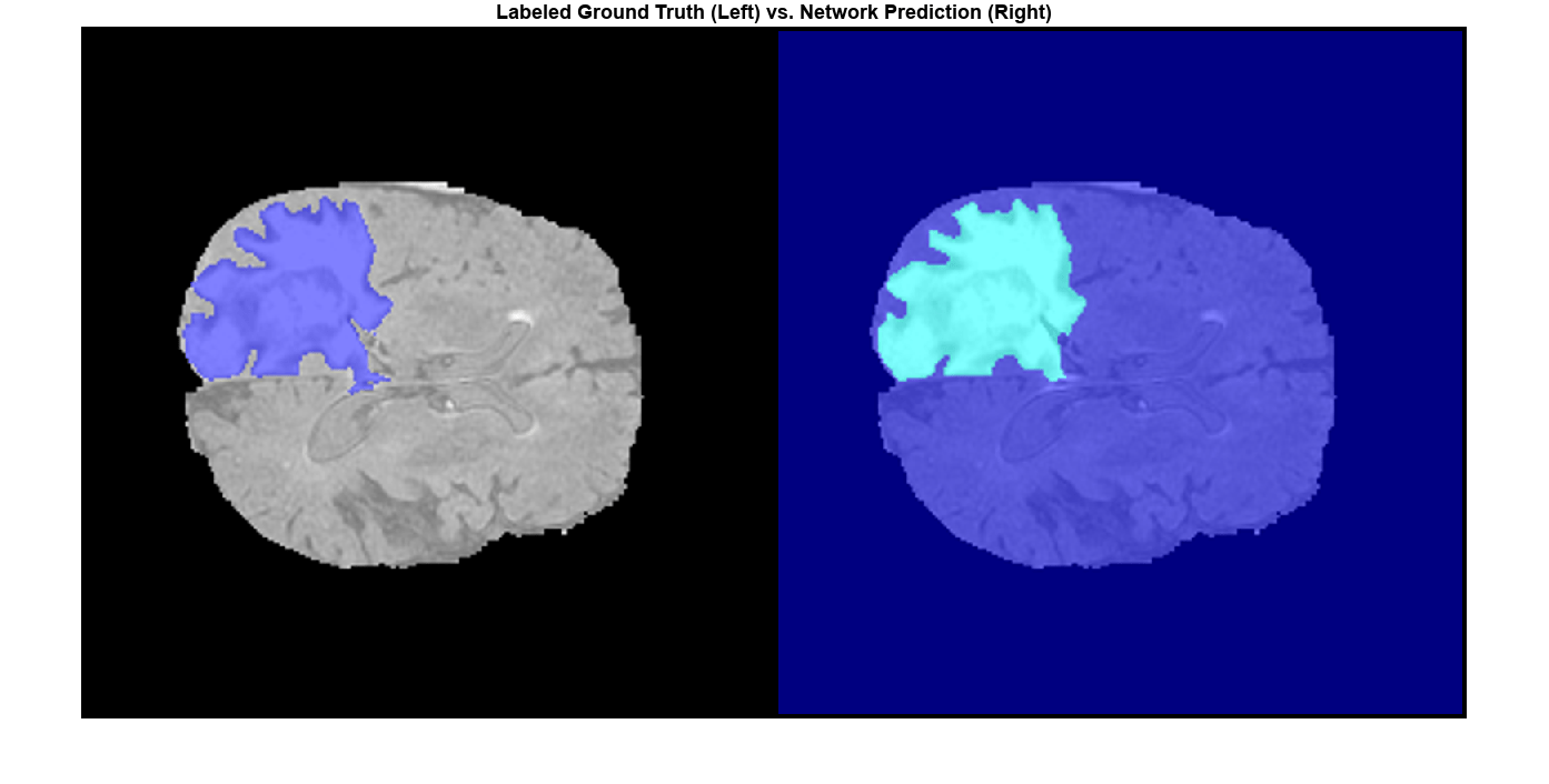 图中包含一个轴对象。标题为“地面真相”(左)和“网络预测”(右)的坐标轴对象包含一个图像类型的对象。