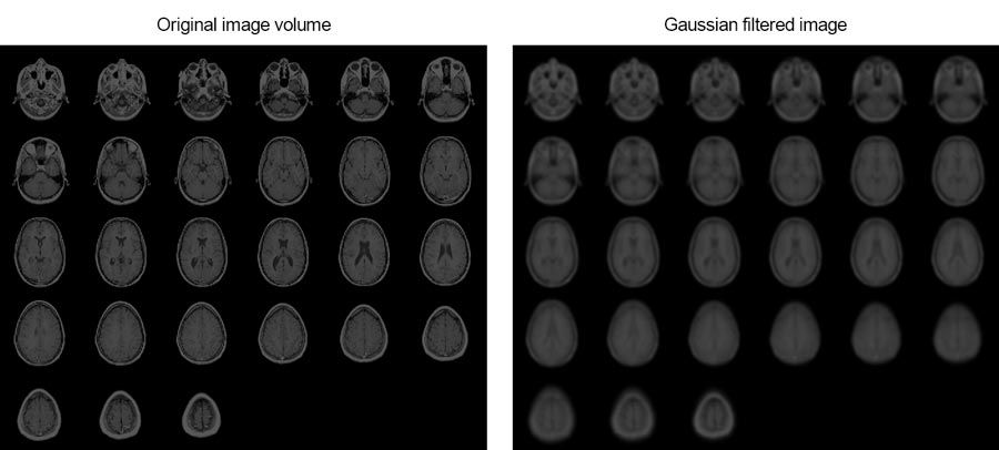 この例では3次元ガウスフィルターを用いて人間の脳のMRI画像を平滑化する方法について説明します。