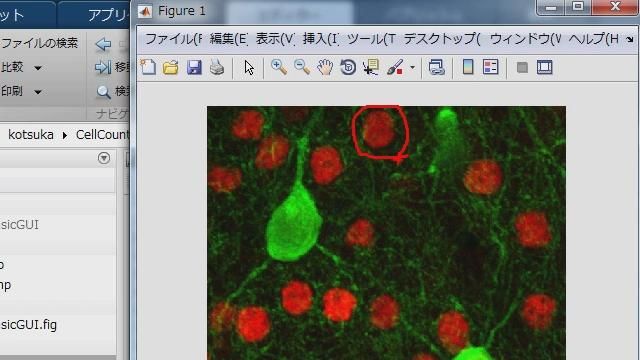 神経細胞の染色画像から,赤色に染色されているコアの数を自動的にカウントする画像処理のアルゴリズムを,MATLAB上で構築していく流れをご紹介します。