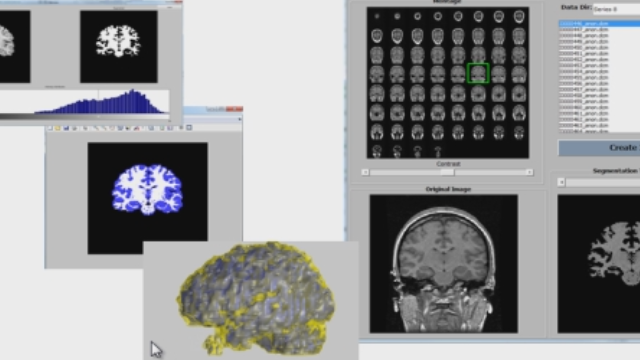 Load an MRI image stack from DICOM files, use segmentation and morphology to identify brain tissue, and create a volume visualization.