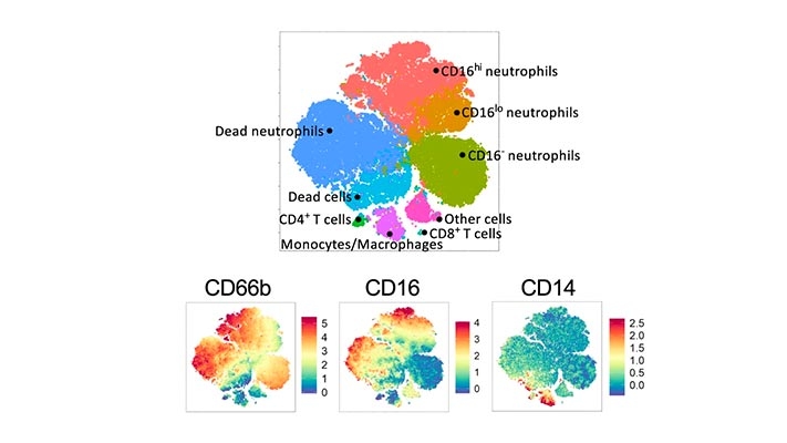 COVID-19患者脑微结构变化——一项基于mri的3个月随访研究