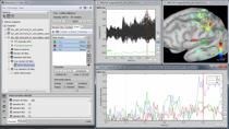 MathWorks and Brainstorm engineers will demonstrate the essential tools offered by Brainstorm to analyse and visualize multidimensional, complex datasets obtained from electrophysiological recordings, with an emphasis on functional brain imaging. We