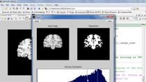 In this webinar, you will learn how to use MATLAB to solve problems using CT, MRI and fluorescein angiogram images.