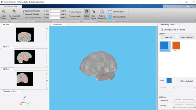 Lleve一个擦玻璃拉segmentación德tumores cerebrales一个partir德imágenesmédicas连接3D CON UNA红色神经掌中。