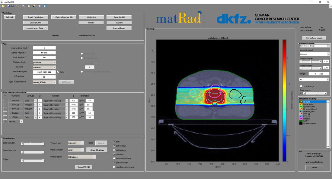 图1。matRad 2.10.0接口，具有工作流、计划、优化和可视化控件。该界面显示了一个前列腺治疗方案使用两个相反的光束角度和扫描的质子