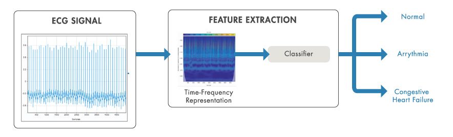 时频分析用于从心电信号中提取特征进行分类。