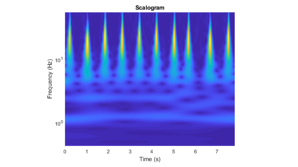 分类时间序列的小波分析和深入学习