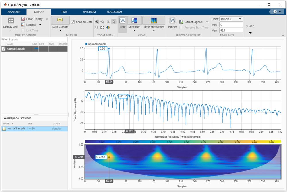 Analyzing an ECG signal in time, frequency and time-frequency domains with the Signal Analyzer app in MATLAB.