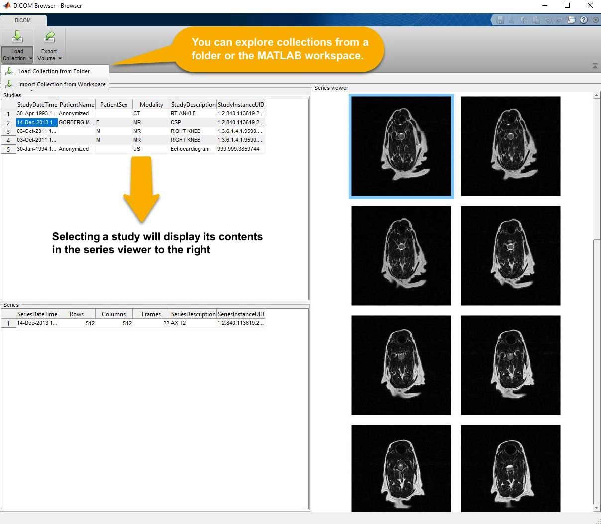 The DICOM Browser app allows you to explore collections of DICOM files and then export the data to other MATLAB apps or the workspace.