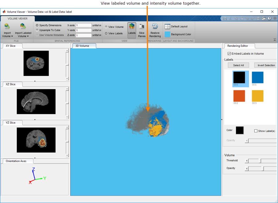 The Volume Viewer app lets you interact with and view 3D volumetric or labeled 3D volumetric data.