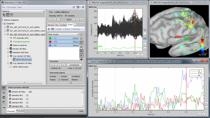 MathWorks和头脑风暴工程师将演示头脑风暴提供的基本工具，以分析和可视化从电生理记录中获得的多维、复杂数据集，重点是功能性脑成像。我们