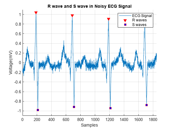 Figure contains an axes object. The axes object with title R wave and S wave in Noisy ECG Signal, xlabel Samples, ylabel Voltage(mV) contains 3 objects of type line. One or more of the lines displays its values using only markers These objects represent ECG Signal, R waves, S waves.