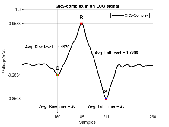 Figure contains an axes object. The axes object with title QRS-complex in an ECG signal, xlabel Samples, ylabel Voltage(mV) contains 11 objects of type line, text. One or more of the lines displays its values using only markers These objects represent QRS-Complex, Peak, Minima.